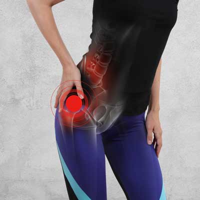 Treatment for Hip Arthritis Without Surgery