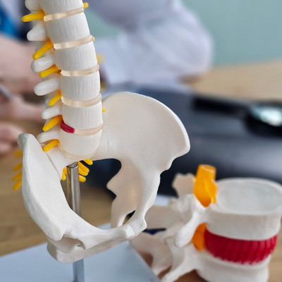 how to prevent herniated disc