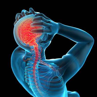 Cervicogenic headaches vs migraines